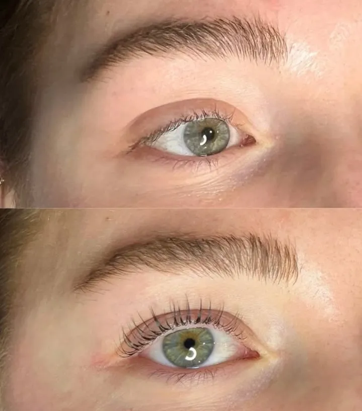 EmGlowSkin before & after result 3