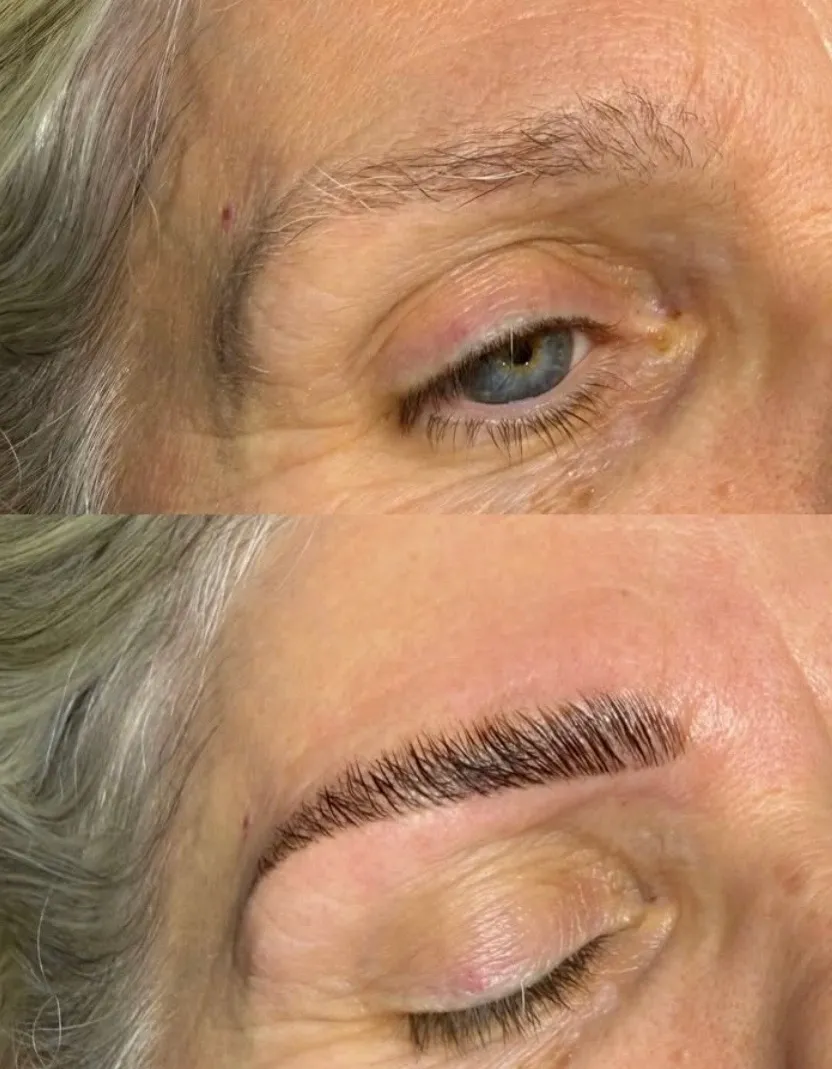 EmGlowSkin before & after result 5