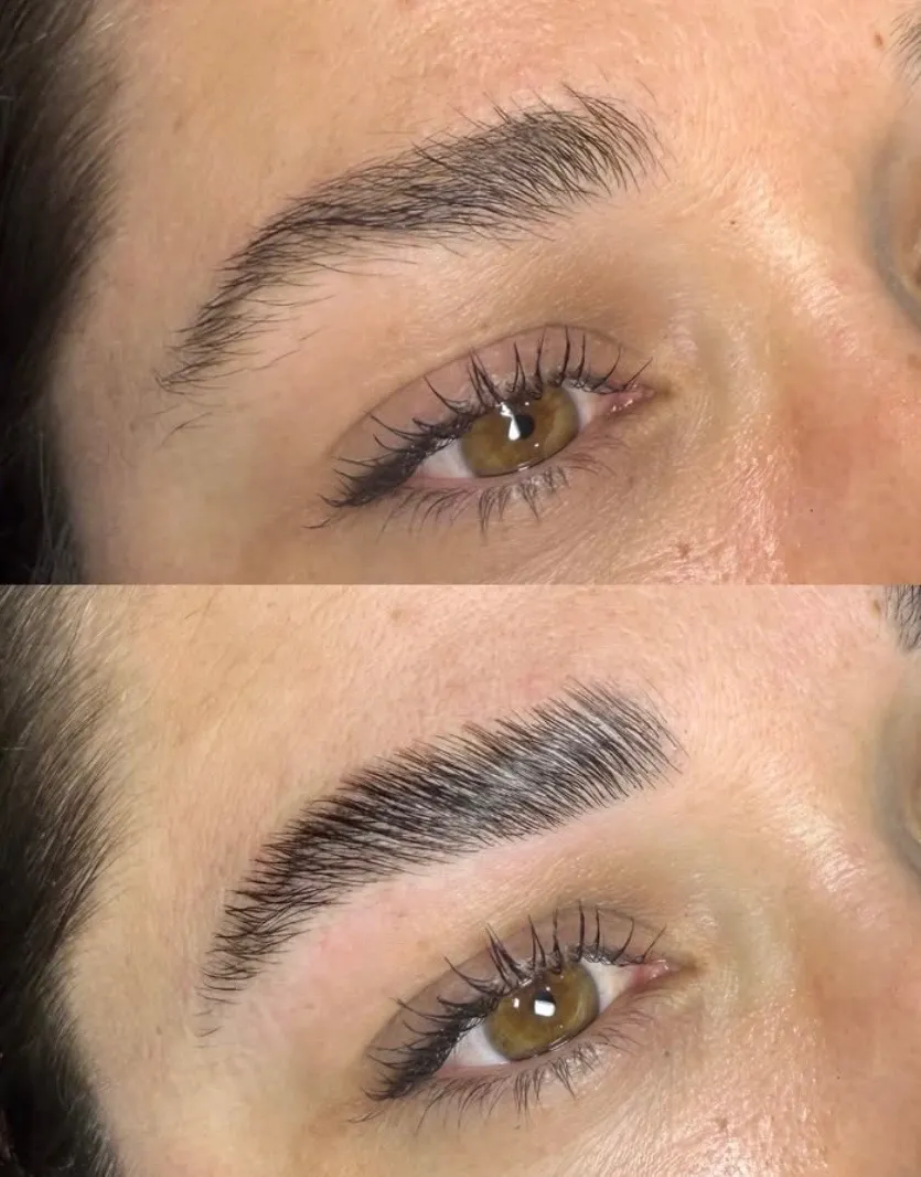 EmGlowSkin before & after result 7